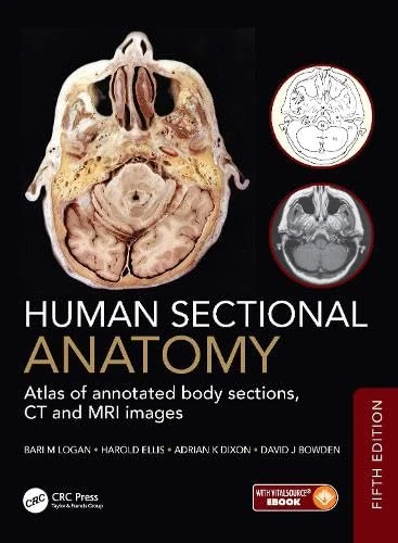 Human Sectional Anatomy: Atlas of annotated body sections, CT and MRI images