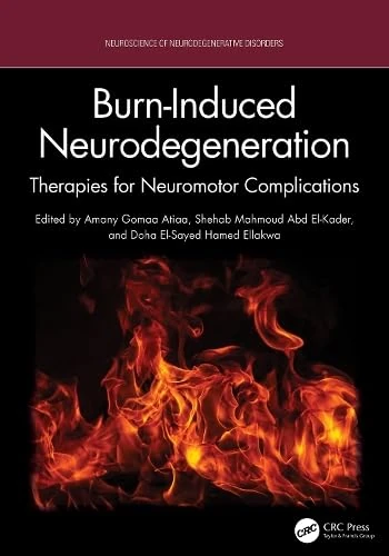 Burn-Induced Neurodegeneration: Therapies for Neuromotor Complications (Neuroscience of Neurodegenerative Disease)
