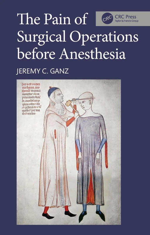 The Pain of Surgical Operations before Anesthesia - Image 1