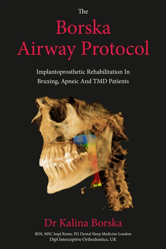 The Borska Airway Protocol: Implantoprosthetic Rehabilitation In Bruxing, Apneic And TMD Patients