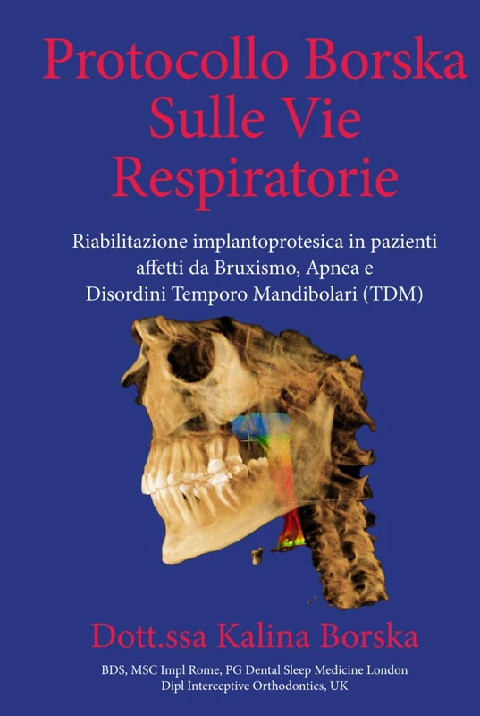 Protocollo Borska Sulle Vie Respiratorie: Riabilitazione implantoprotesica in pazienti affetti da Bruxismo, Apnea e Disordini Temporo Mandibolari (TDM)