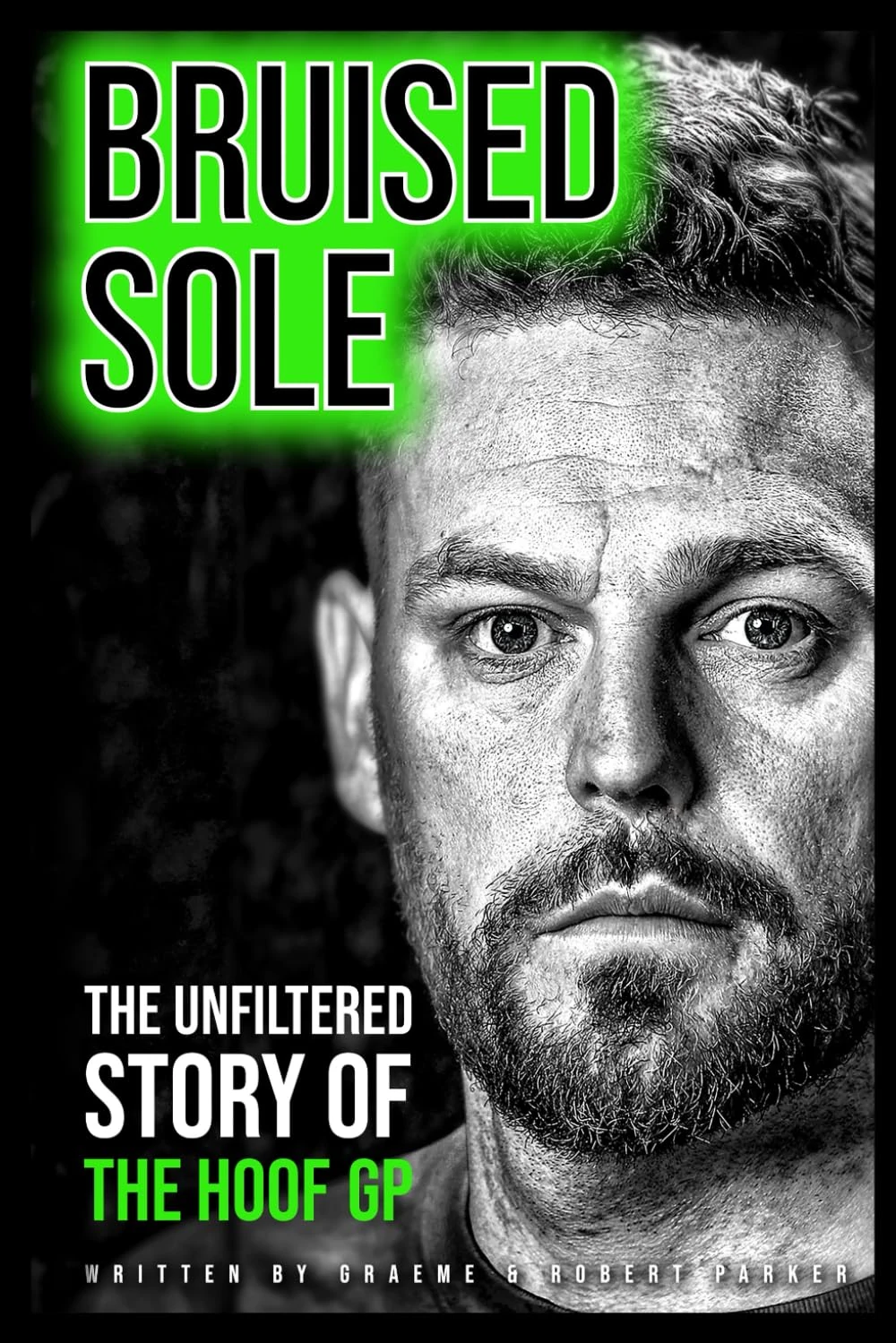 Bruised Sole: The Unfiltered Story Of The Hoof GP