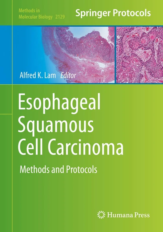 Humana Esophageal Squamous Cell Carcinoma Methods and Protocols