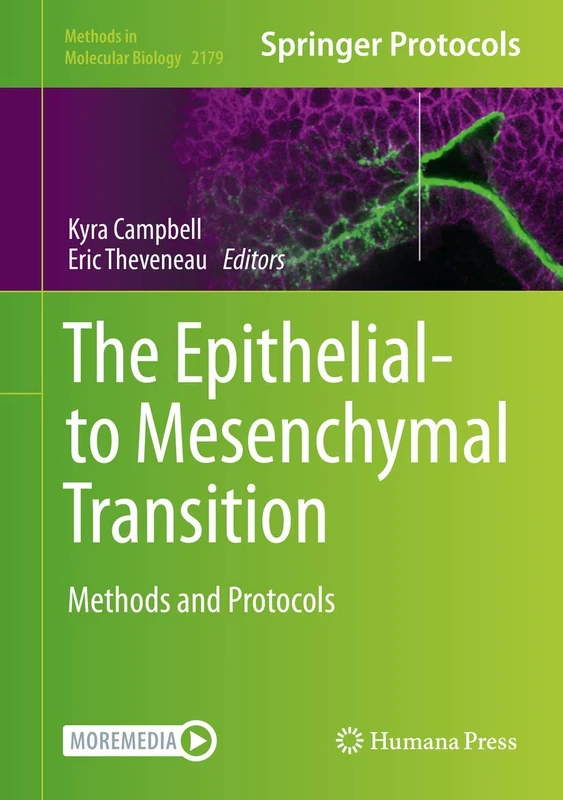 The Epithelial-to Mesenchymal Transition: Methods and Protocols: 2179 (Methods in Molecular Biology, 2179)