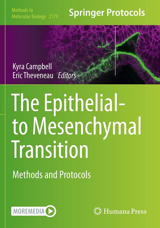 The Epithelial-to Mesenchymal Transition: Methods and Protocols: 2179 (Methods in Molecular Biology, 2179)