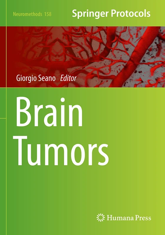 Springer Brain Tumors: 158 (Neuromethods, 158) Medical Text