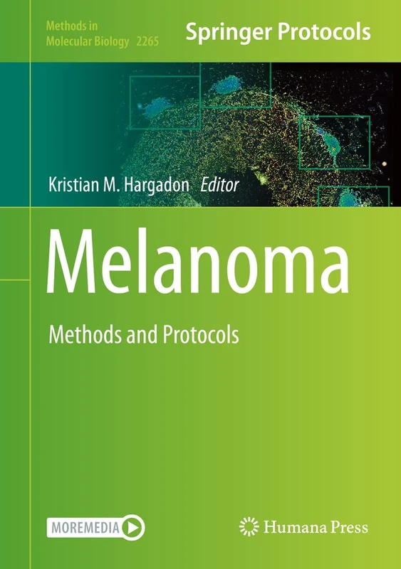 Melanoma: Methods and Protocols: 2265 (Methods in Molecular Biology, 2265)