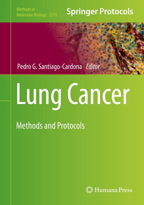 Humana Lung Cancer: Methods and Protocols 2279 Book