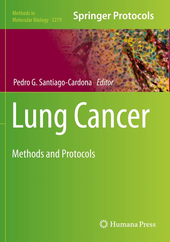 Lung Cancer: Methods and Protocols: 2279 (Methods in Molecular Biology, 2279)