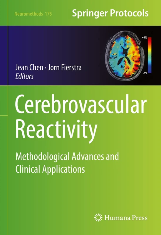 Humana Cerebrovascular Reactivity - Neuromethods 175 Book