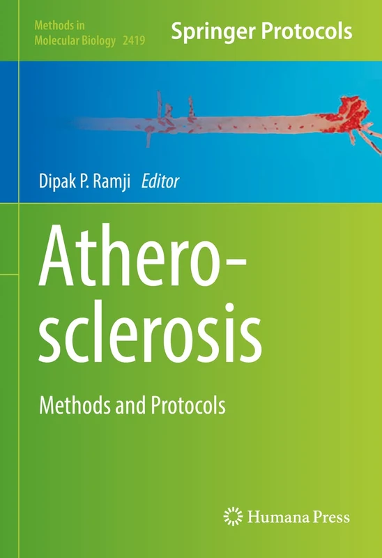 Atherosclerosis: Methods and Protocols: 2419 (Methods in Molecular Biology, 2419)