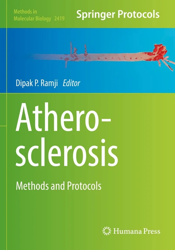 Atherosclerosis: Methods and Protocols: 2419 (Methods in Molecular Biology, 2419)