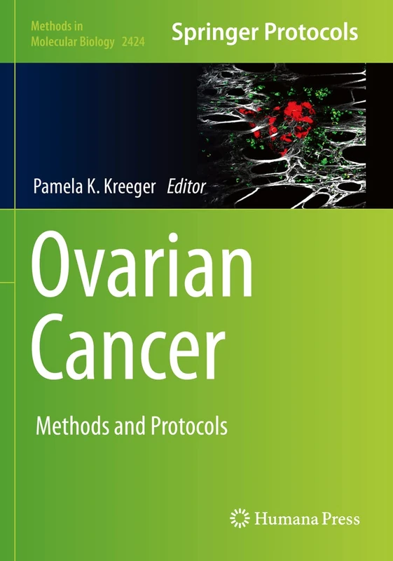 Humana Ovarian Cancer: Methods and Protocols 2424 Book - Image 1
