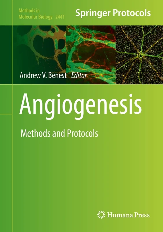 Angiogenesis: Methods and Protocols: 2441 (Methods in Molecular Biology, 2441)