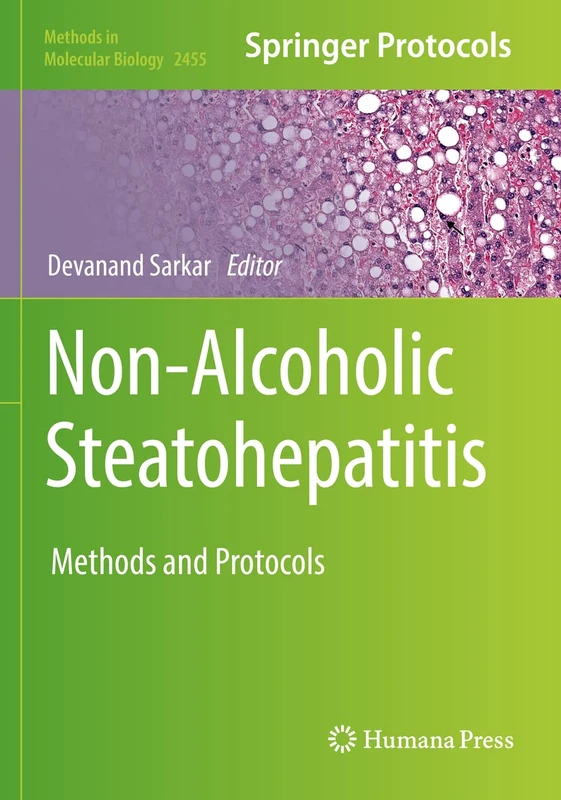 Humana Non-Alcoholic Steatohepatitis Methods and Protocols 2455