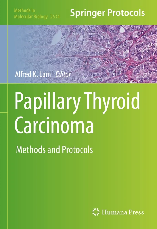 Papillary Thyroid Carcinoma: Methods and Protocols: 2534 (Methods in Molecular Biology, 2534)
