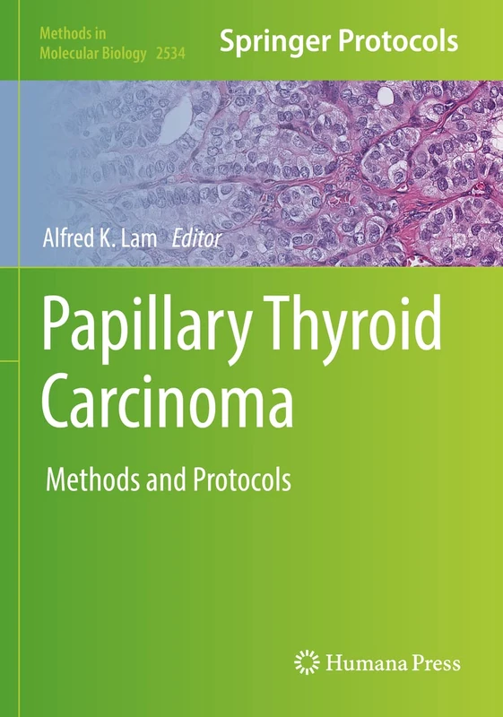Papillary Thyroid Carcinoma: Methods and Protocols: 2534 (Methods in Molecular Biology, 2534)
