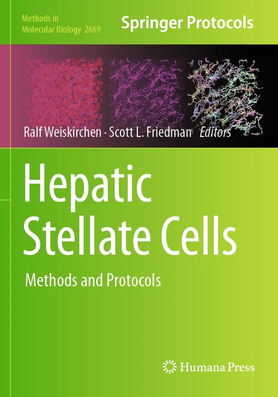 Humana Hepatic Stellate Cells: Methods and Protocols 2669