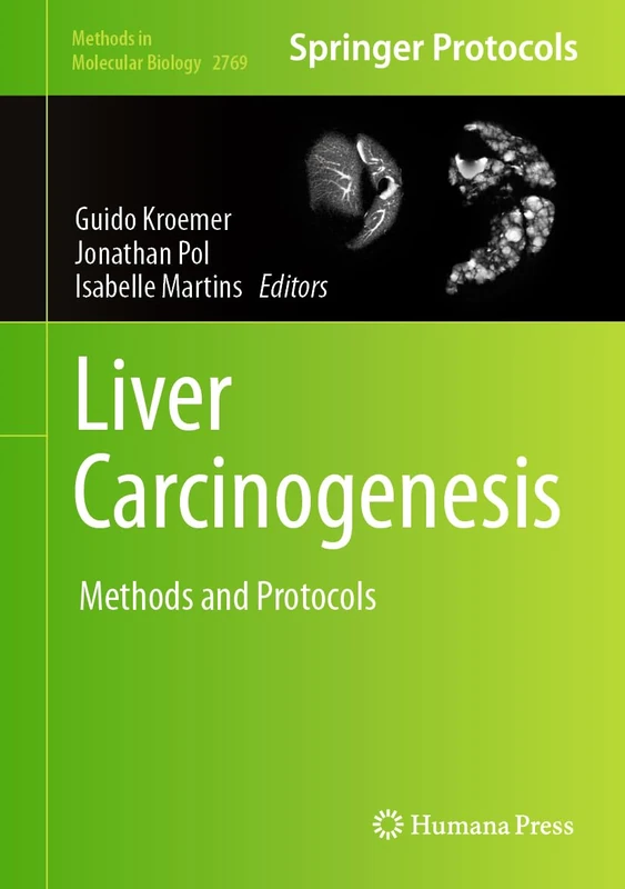 Liver Carcinogenesis: Methods and Protocols: 2769 (Methods in Molecular Biology, 2769)