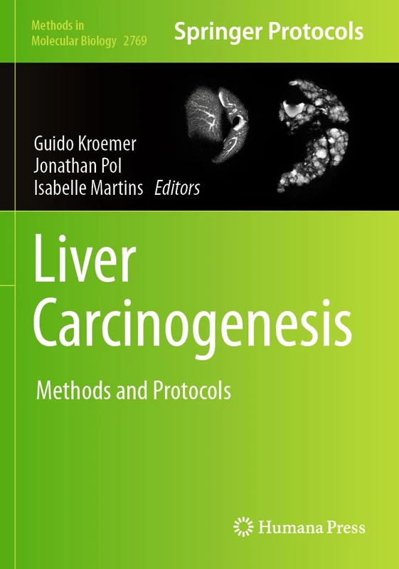Liver Carcinogenesis: Methods and Protocols: 2769 (Methods in Molecular Biology, 2769)