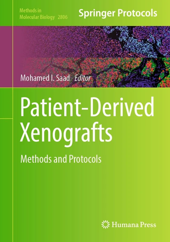 Patient-Derived Xenografts: Methods and Protocols: 2806 (Methods in Molecular Biology, 2806)