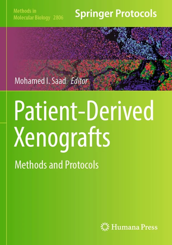Patient-Derived Xenografts: Methods and Protocols: 2806 (Methods in Molecular Biology, 2806)
