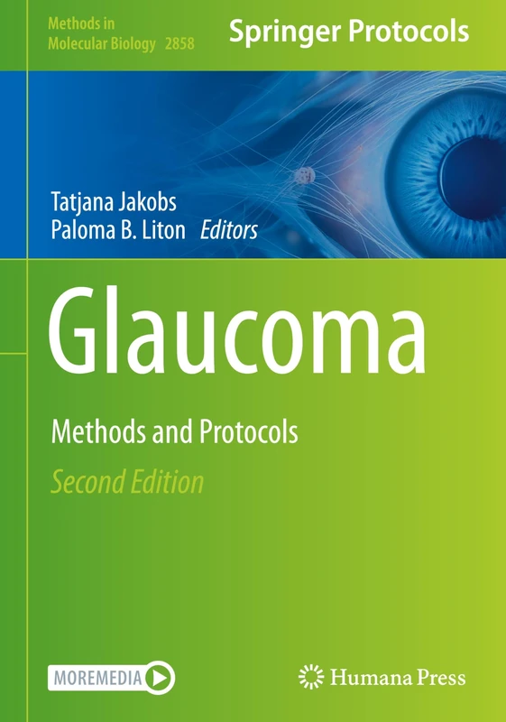 Humana Glaucoma: Methods and Protocols 2858 - Medical Book - Image 1