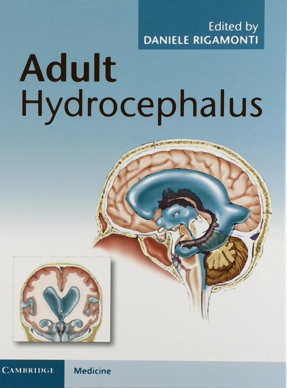 Adult Hydrocephalus - Image 1