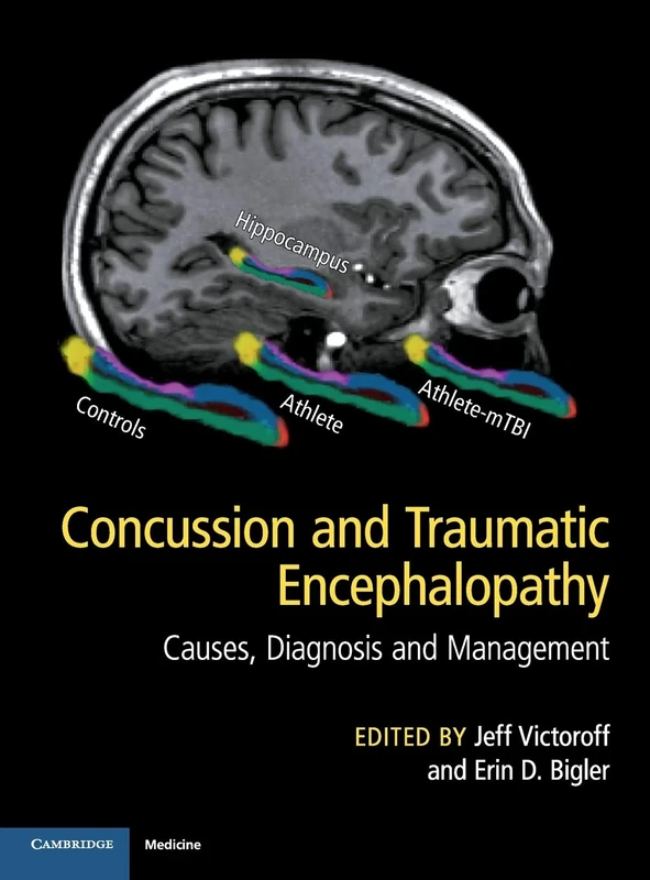 Concussion and Traumatic Encephalopathy: Causes, Diagnosis and Management