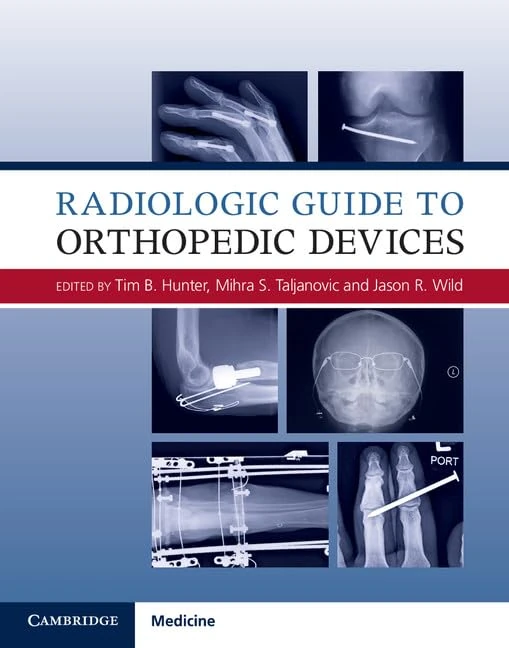 Cambridge University Press Radiologic Guide to Orthopedic Devices
