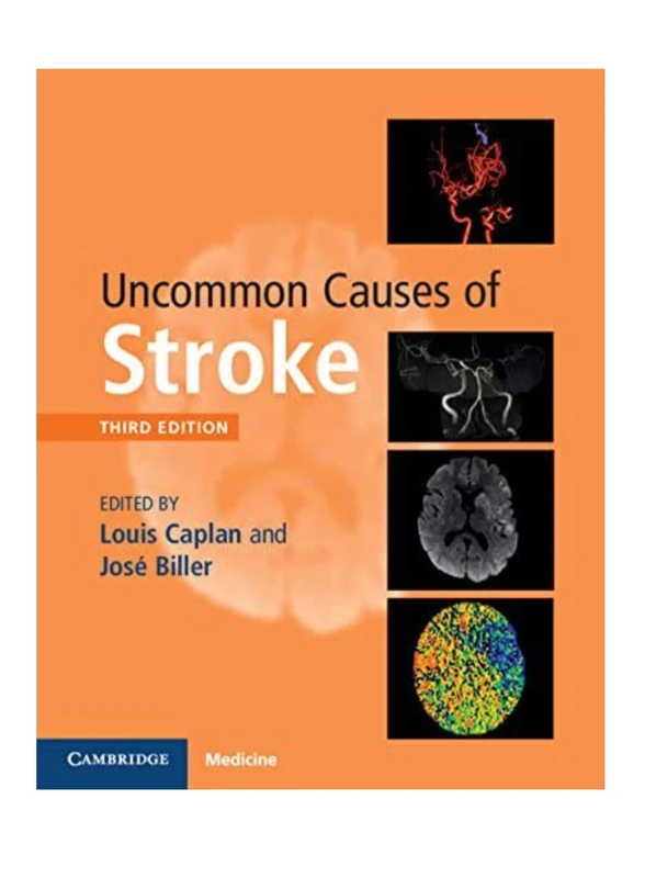 Uncommon Causes of Stroke