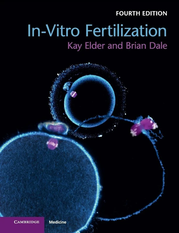 In-Vitro Fertilization