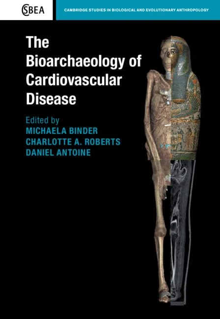 The Bioarchaeology of Cardiovascular Disease: Series Number 91 (Cambridge Studies in Biological and Evolutionary Anthropology, Series Number 91)