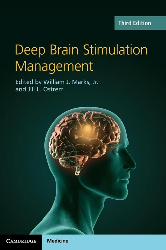 Deep Brain Stimulation Management