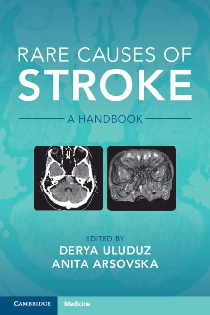 Rare Causes of Stroke: A Handbook