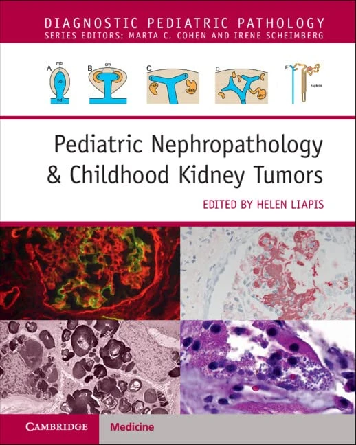 Cambridge Pediatric Nephropathology & Childhood Kidney Tumors
