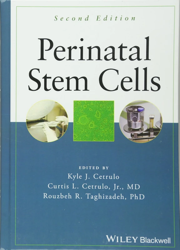 Perinatal Stem Cells