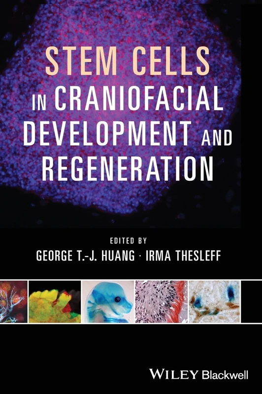 Stem Cells in Craniofacial Development and Regeneration