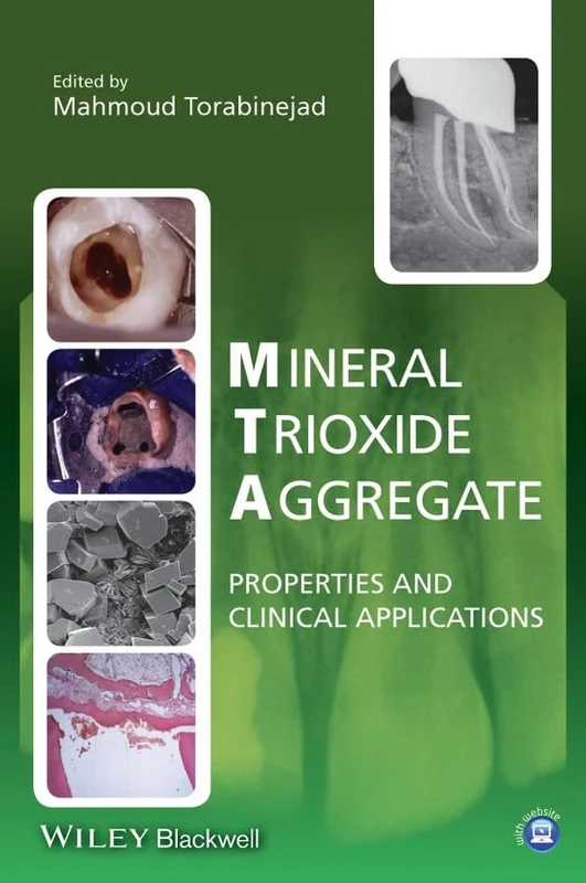 Mineral Trioxide Aggregate: Properties and Clinical Applications - Image 1