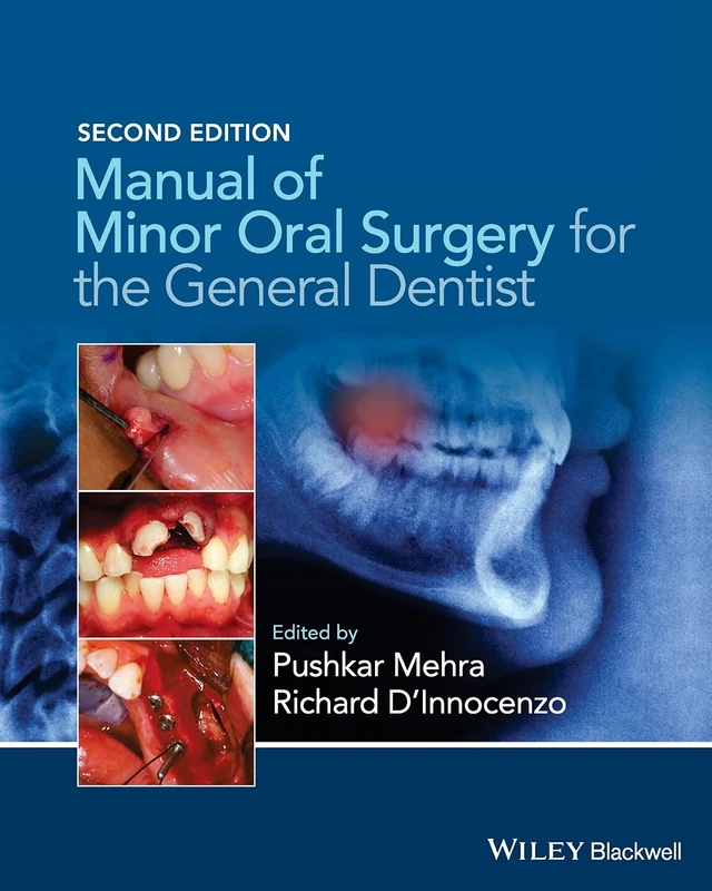 Manual of Minor Oral Surgery for the General Dentist, 2nd Edition