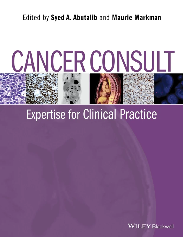 Wiley-Blackwell Cancer Consult: Expertise for Clinical Practice