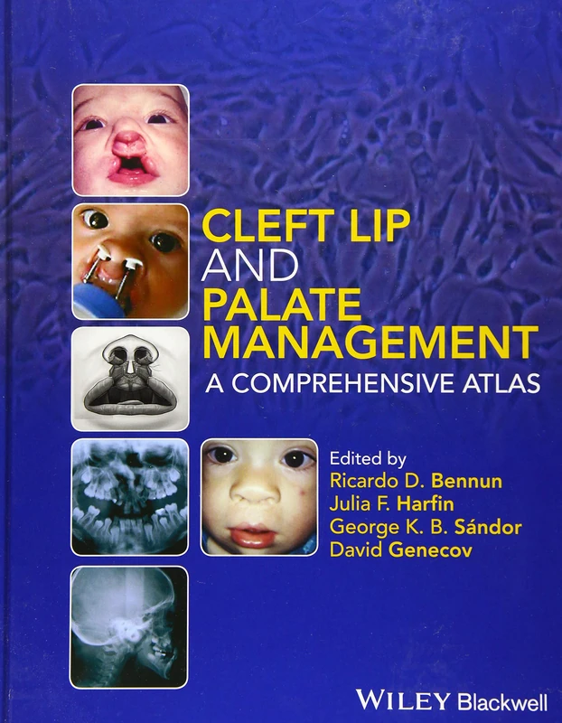 Cleft Lip and Palate Management: A Comprehensive Atlas