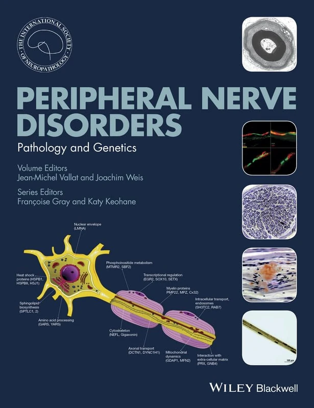 Peripheral Nerve Disorders: Pathology and Genetics (International Society of Neuropathology Series)