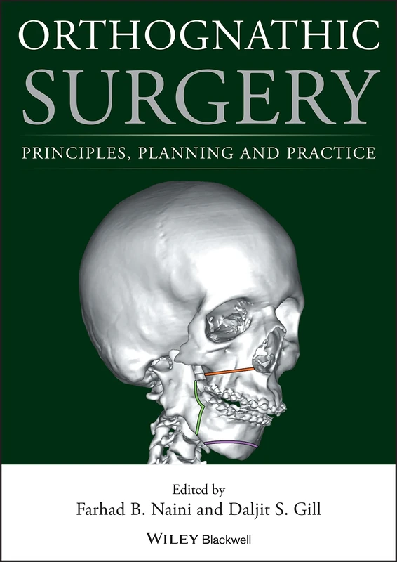 Orthognathic Surgery: Principles, Planning and Practice