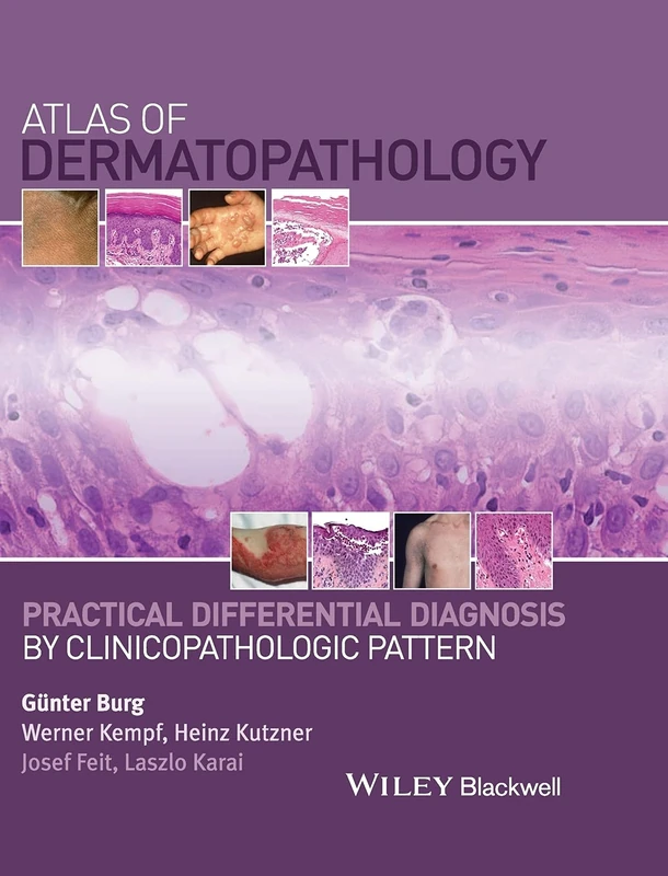 Atlas of Dermatopathology: Practical Differential Diagnosis by Clinicopathologic Pattern