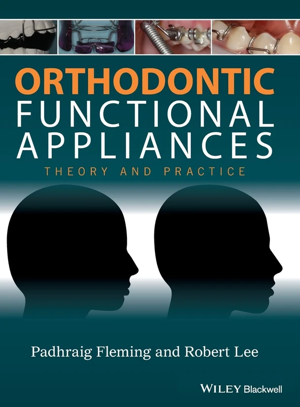 Orthodontic Functional Appliances: Theory and Practice