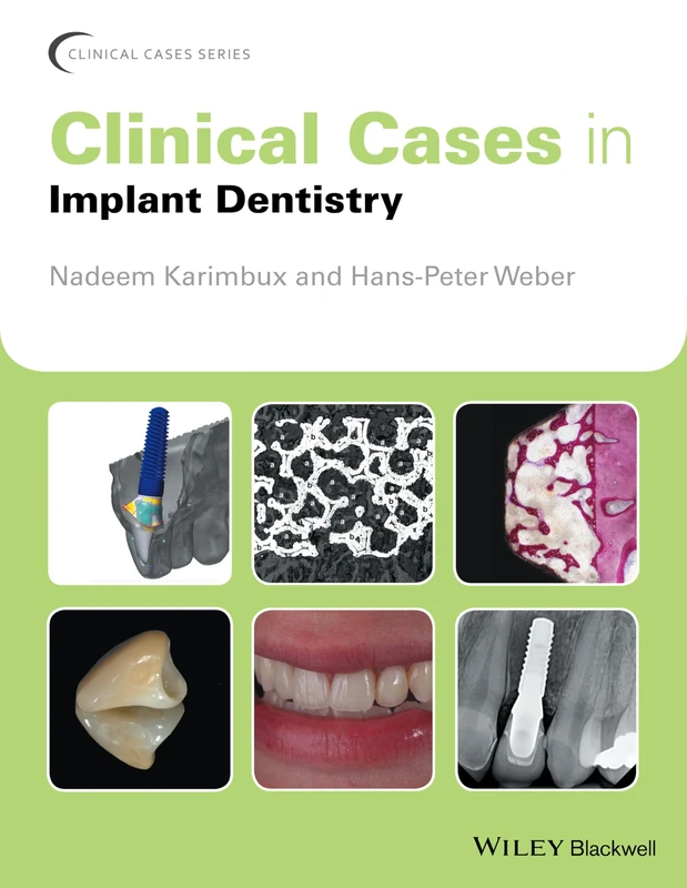Clinical Cases in Implant Dentistry (Clinical Cases (Dentistry))