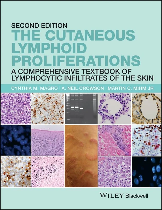 The Cutaneous Lymphoid Proliferations: A Comprehensive Textbook of Lymphocytic Infiltrates of the Skin