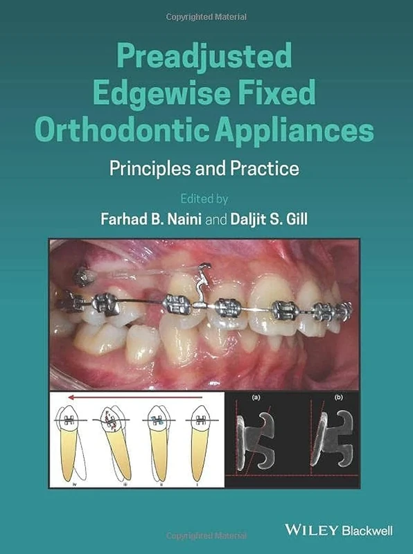 Preadjusted Edgewise Fixed Orthodontic Appliances: Principles and Practice