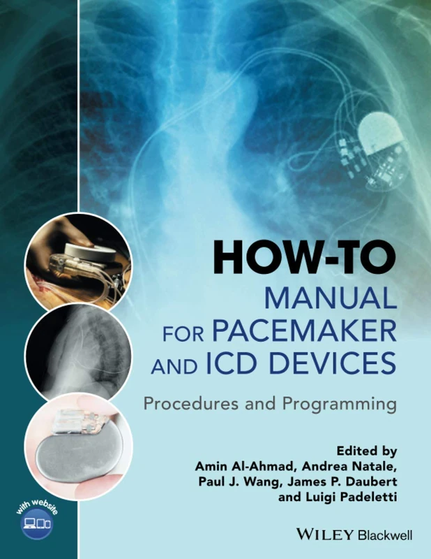 How-to Manual for Pacemaker and ICD Devices: Procedures and Programming